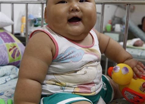 Overweight Children Life Expectancy — Fat Kids Die Before Parents