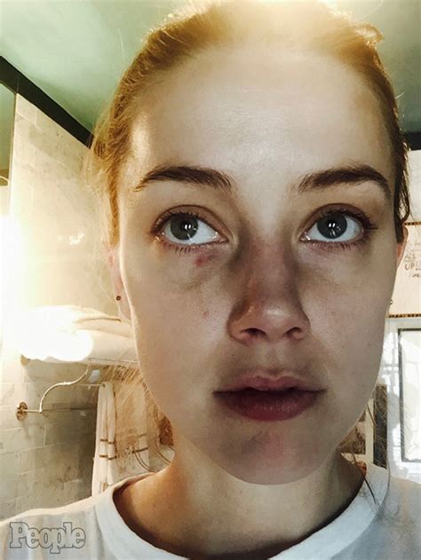 Amber Heard Documents Alleged Abuse By Johnny Depp With Newly Released