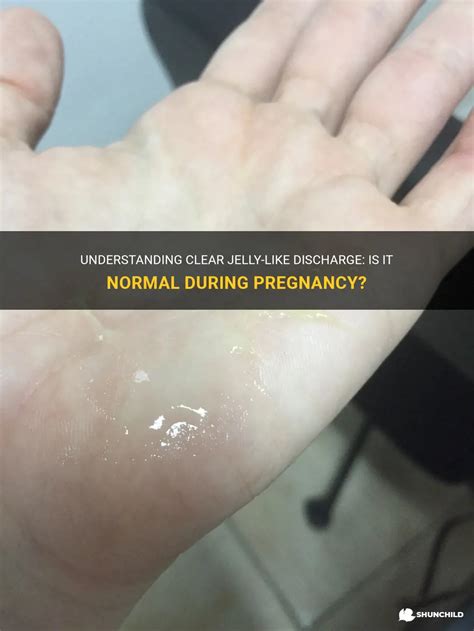 Understanding Clear Jelly Like Discharge Is It Normal During Pregnancy