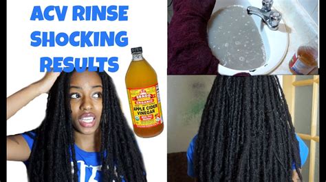 Acv Rinse For Locs Without Baking Soda