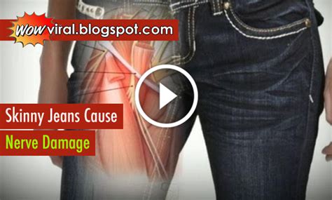 Wow Viral Dangerous Fashion Skinny Jeans Cause Permanent Muscle And Nerve Damage