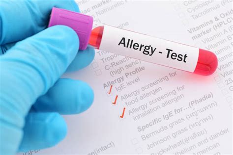 Allergy Test Stock Photos Pictures And Royalty Free Images Istock