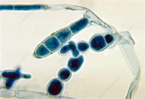 Epidermophyton Floccosum Fungus Light Micrograph Stock Image C057
