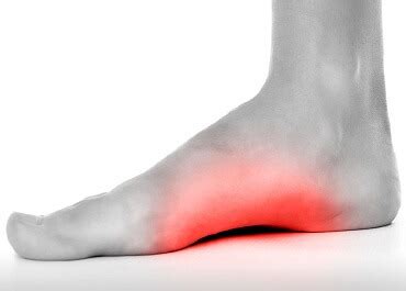 Bunions are hard and bony, while bursitis is softer because the sacs are filled with fluid. when bursitis affects the big toe, it's typically the result of wearing shoes that are too tight, he adds. Foot Arch Pain: Causes & Treatment - Foot Pain Explored