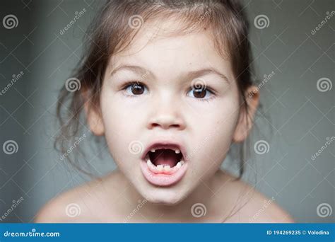 Portrait Of A Little Toothless Girl Stock Image Image Of Happy