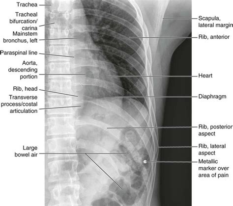 Normal Anatomy Radiology Key
