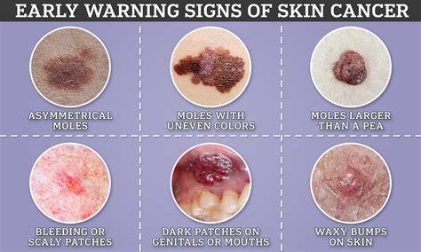 Top 10 Skin Diseases You Must Be Aware Of