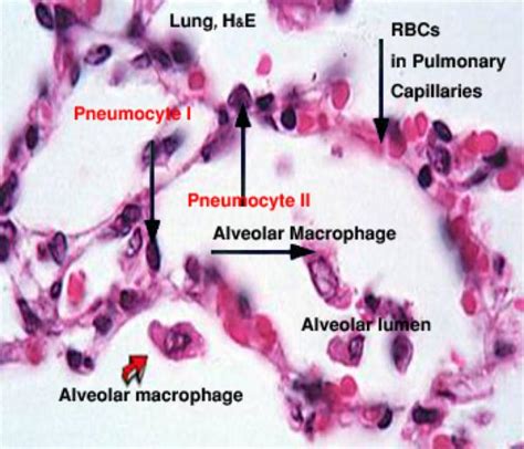 Alveolar Macrophage Histology The Best Porn Website