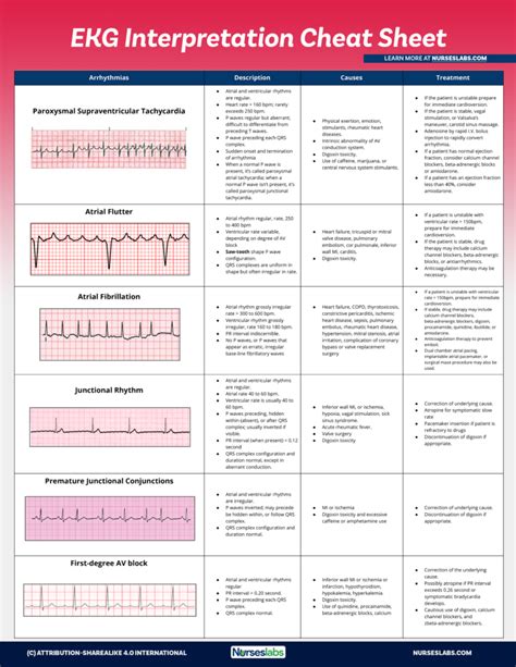 Ekg Interpretation Cheat Sheet Heart Arrhythmias Guide 2020 Update Zohal