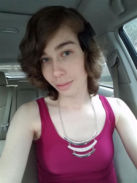 Mtf 7 Months Hrt3 Laser Sessions In 29 Years Old How Am I Doing