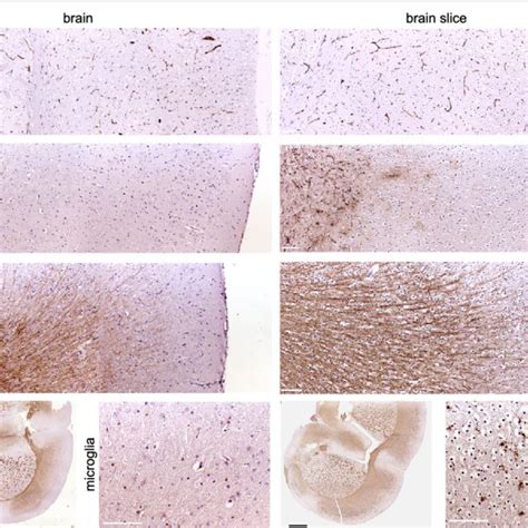 Organotypic Brain Slice Cultures Maintain Characteristic Features Of