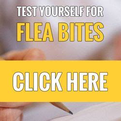 How to treat flea bites and get rid of fleas in your home. Pin on Dog's & Anything That's Helpful For Me!!