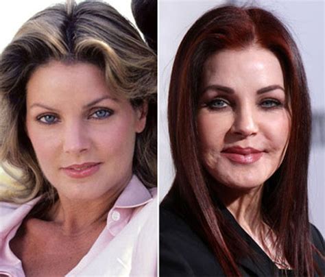 Priscilla Presley This Is What Happens When You Inject Silicone Caulk For Bath Celebrity