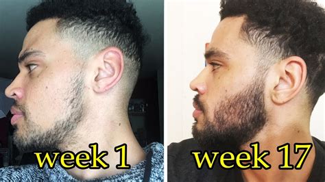 Minoxidil is thought to induce an early anagen phase when it's applied to your scalp, meaning it can cause hair follicles to go through the rest of the growth process prematurely before starting to grow again. My Minoxidil Beard Journey : Week 17 || Pre Minox Photos ...