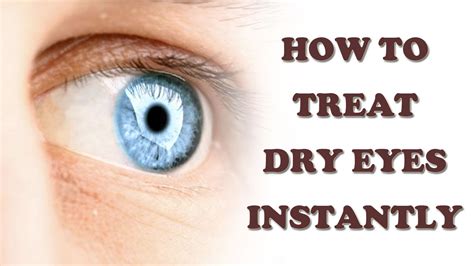 Dry Eyes Cure How To Cure Dry Eyes Naturally Dry Eyes Treatment