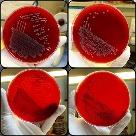 Gram Negative Lactose Fermenter Bacteria How To Differentiate 💡🔆👌