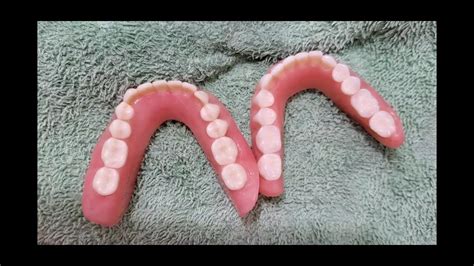 Immediate And Permanent Lower Denture Youtube