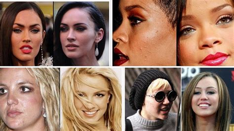 10 Beautiful Celebrities With Surprising Acne Scars 2018 Youtube
