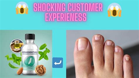 kerassentials remove your smelly feet price benefits homify