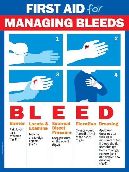 First Aid For Managing Bleeds Safety Poster Shop
