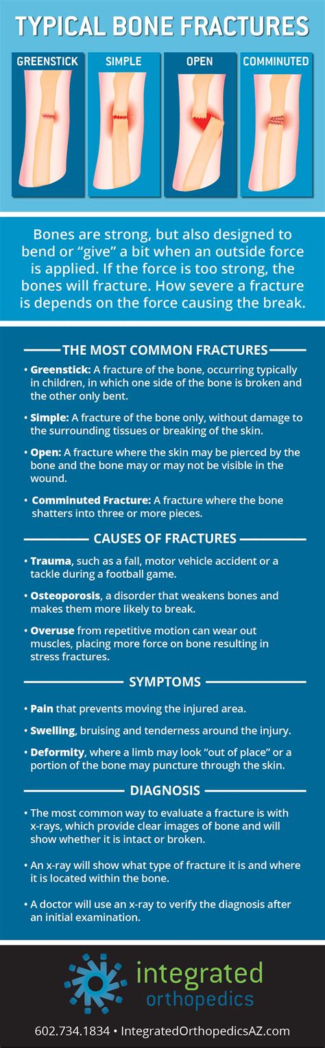 Typical Bone Fractures Causes Symptoms And Diagnosis Integrated