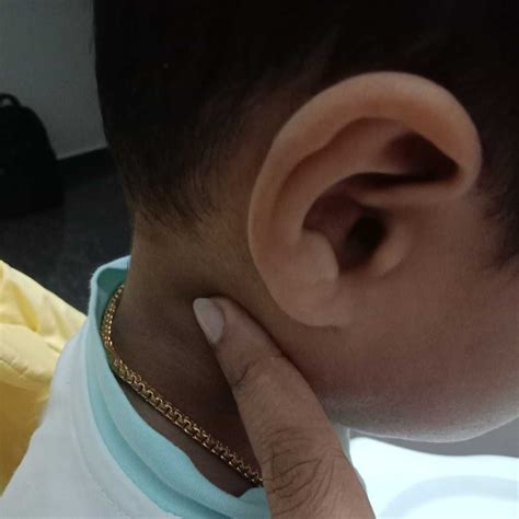 Swollen Lymph Nodes In Neck In Children