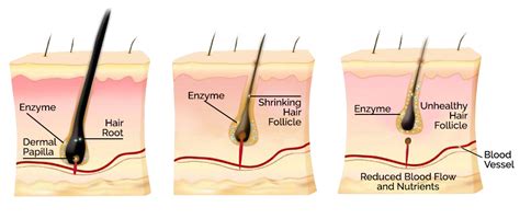About Hair Loss Stemson Therapeutics