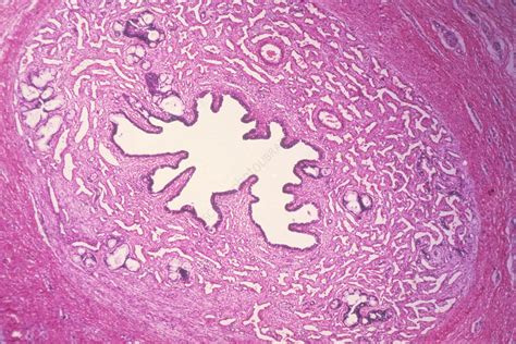 Corpus Cavernosum Urethrae (LM) - Stock Image - C014/4323 - Science ...