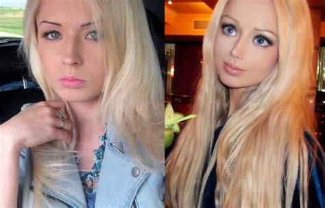 Human Barbie Before And After Plastic Surgery Valeriya Lukyanova Surgury Mommy Makeover