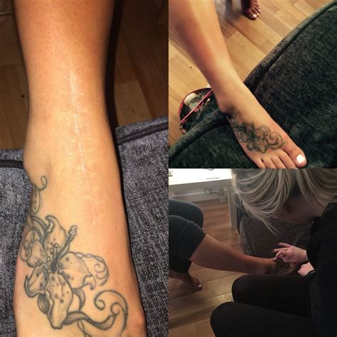 Tattoos over scars are something that comes to mind when trying to figure out a way to get rid scars you want to hide, but can you tattoo over scars? Pin on Halesowen College Theatrical Makeup 2015/16