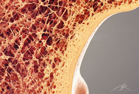 This page is about femur bone cross section,contains bone cross section 3d. Newt Studios - Bone Cross Section