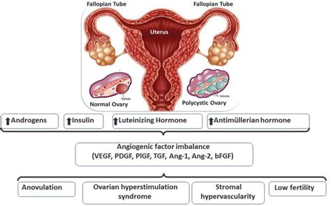 Pathophysiology Of Polycystic Ovarian Syndrome Intechopen