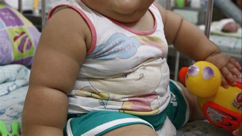 Larger Babies More Likely To Be Obese As Adults