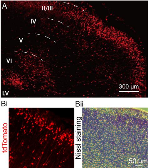 In Utero Electroporation Of Cre Plasmid In The Brains Of Floxed Stop