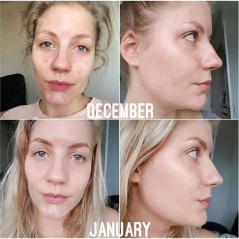 Thank you the ordinary for creating such an. VIBRANT GLAMOUR Ordinary Niacinamide - Face Serum Oil ...