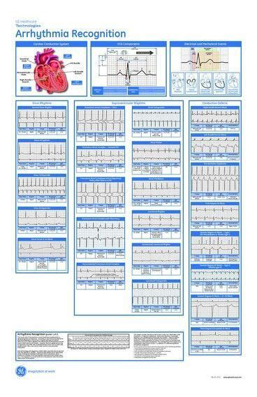 Printable Acls Cheat Sheet