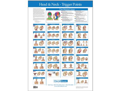 Anatomical Chart Head And Neck Trigger Points A 1 Medical Integration
