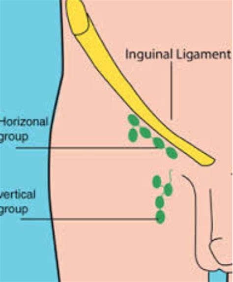 Although testicle pain and groin pain are different, a testicle condition can sometimes cause pain that spreads to the groin area. Inguinal lymph nodes - Wikiwand
