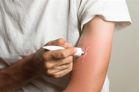 Sunburns And Sunscreen Sunburn Treatments And Spf Tips The Healthy