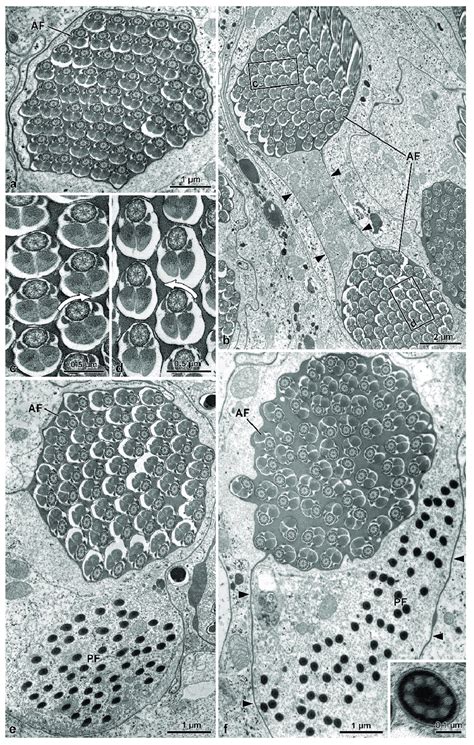 Mordellistena Brevicauda The Figure Illustrates Sections Of The Sperm