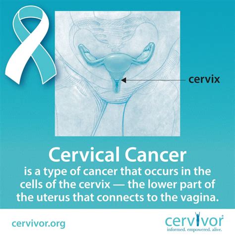 What You Need To Know About Cervical Cancer Prevention Cervivor