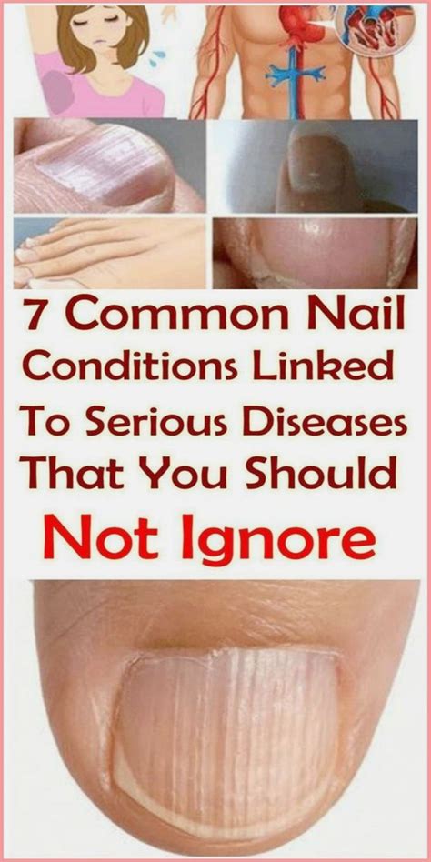 Pin By Adalupenkova On Health Nail Conditions White Nail Beds Blue