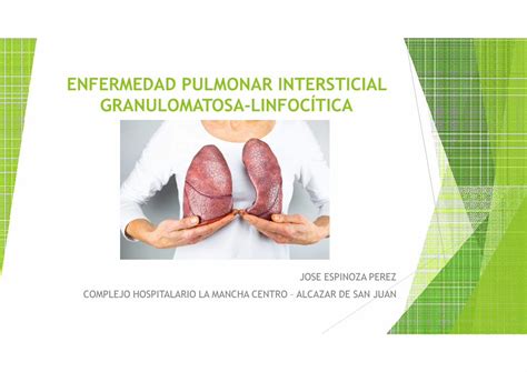 PDF ENFERMEDAD PULMONAR INTERSTICIAL Linfoproliferativa