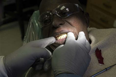 ‘its Tough To Go Around Without Teeth Texas Prisons Start 3d Denture
