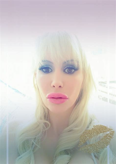Sandra Star On Twitter 💋 I Love My New Fantastic Plastic Lips 💋