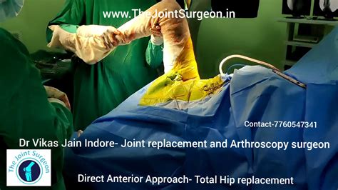 Hip Replacement Direct Anterior Approach With Scarless Bikini Incision