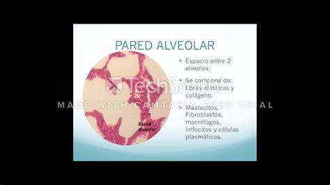 HistologÍa De Alveolos Youtube