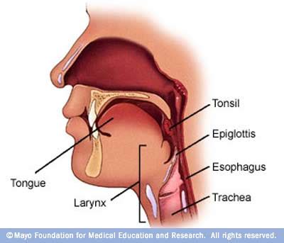 Food stuck in throat won t go down. David T. Anderson: Meet PEG