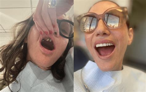 What Happened To Jenna Lyons Teeth Before And After Photo