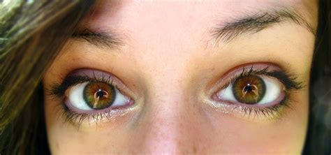 Best R Eyes Images On Pholder Hazel Or Central Heterochromia